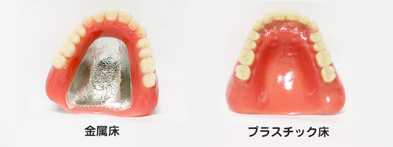 南大沢の歯医者、サンライズ歯科の入れ歯の写真。金属を使った入れ歯と、プラスチックが「床」の素材の入れ歯比較写真