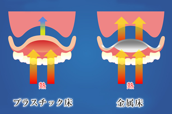 南大沢の歯医者、サンライズ歯科の入れ歯の熱電動について説明する比較図