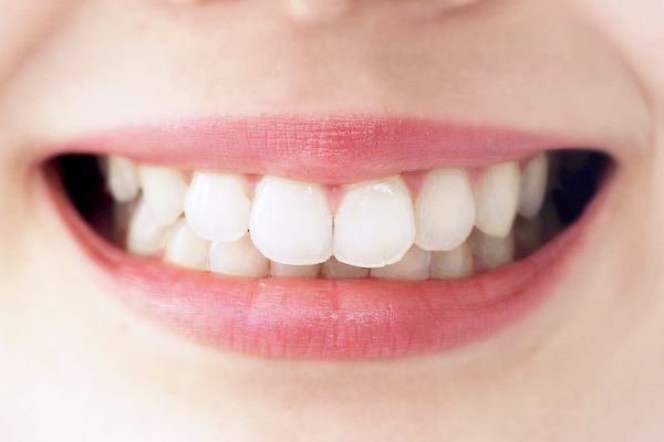 南大沢の歯医者、サンライズ歯科の口元の美しさをイメージさせる写真